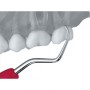 Кюрета для работы с молярами Gracey 9/10 LM 209-210