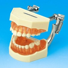 Модель из 20 зубами с прозрачным десневым ложем и анатомической корневой системой зубов (снимаемых)
