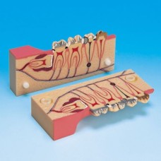 Модель с саггитальным разрезом показывающая зубы с нормальной и патологически измененной пульпой