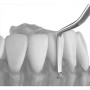 Скейлер-мотыга для работы на передних и щечных поверхностях Hoe Scaler anterior LM 112-113