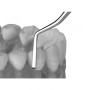 Скейлер-мотыга для работы на язычных и вестибулярных поверхностях Hoe Scaler lateral LM 134-135